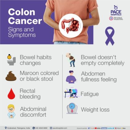 Early Detection Matters: Identifying Colon Cancer Symptoms in Women ...